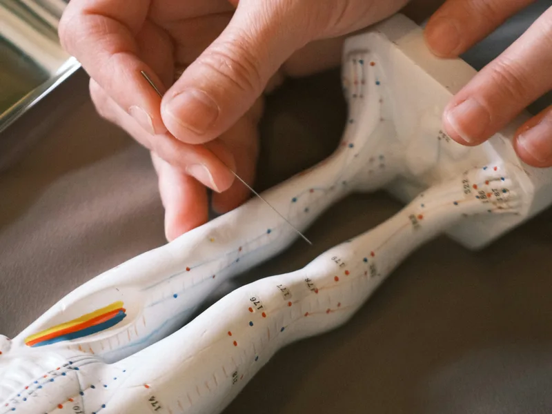Acupuncture at Lincoln Park Rehab in Miramar