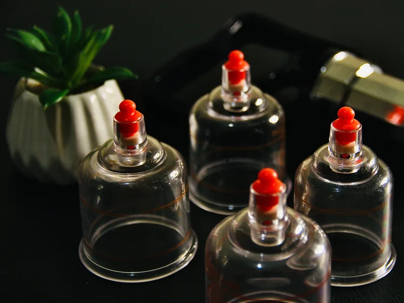 How Cupping Therapy works at Lincoln Park Rehab