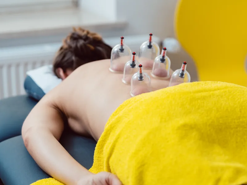 Cupping Therapy at Lincoln Park Rehab in Miramar