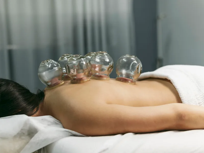 Cupping Therapy at Lincoln Park Rehab in Miramar