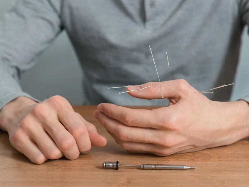 Dry Needling at Lincoln Park Rehab in Miramar